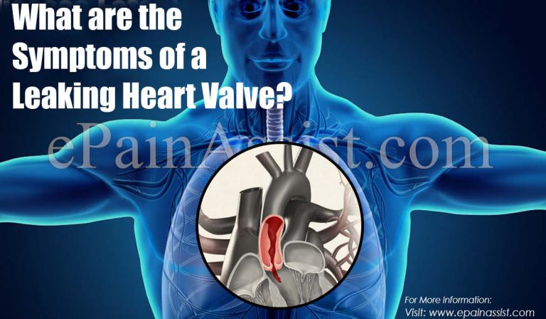 What are the Symptoms of a Leaking Heart Valve?