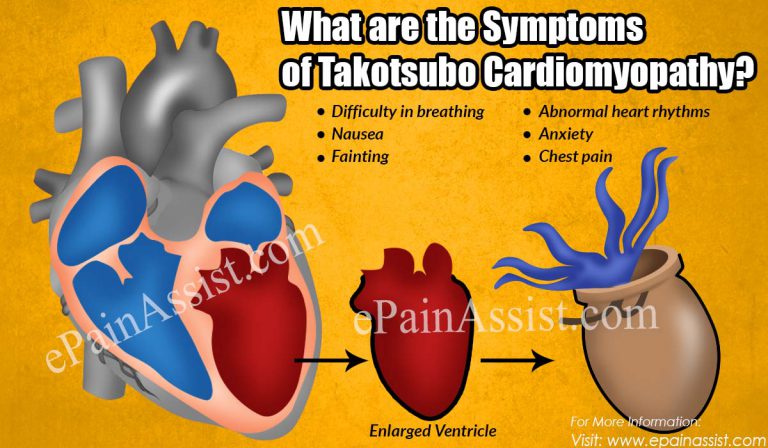 What are the Symptoms of Takotsubo Cardiomyopathy?