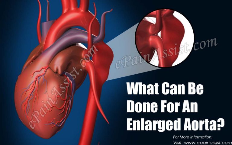 What Can Be Done For An Enlarged Aorta