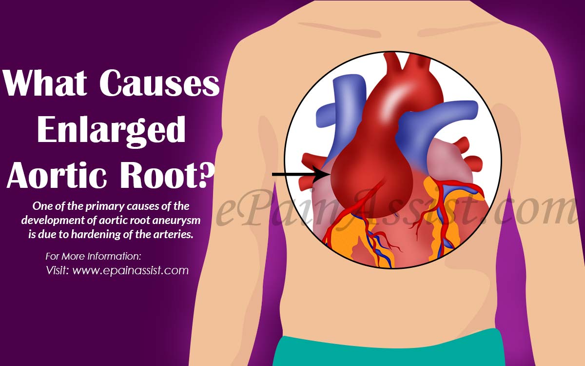 What Causes Enlarged Aortic Root?