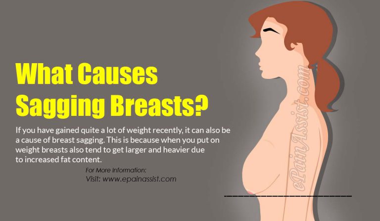 What Causes Sagging Breasts?