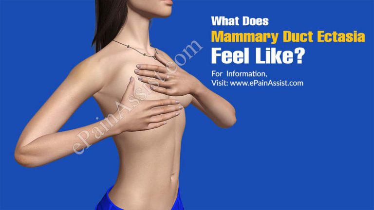 What Does Mammary Duct Ectasia Feel Like?