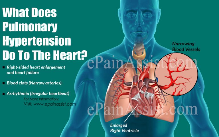 What Does Pulmonary Hypertension Do To The Heart?