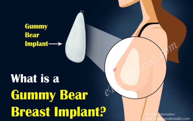 What is a Gummy Bear Breast Implant?