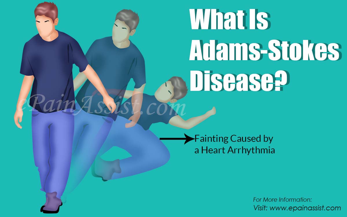 What Is Adams-Stokes Disease?