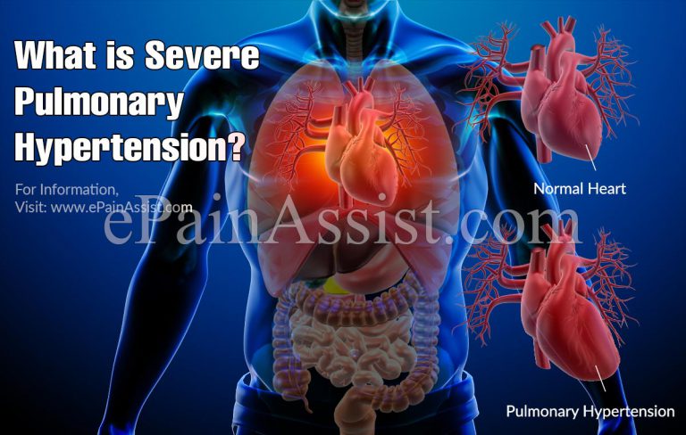 What Is Severe Pulmonary Hypertension?
