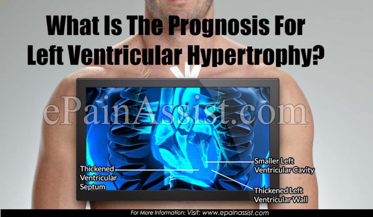 What Is The Prognosis For Left Ventricular Hypertrophy?