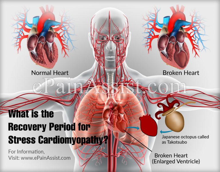 What is the Recovery Period for Stress Cardiomyopathy?