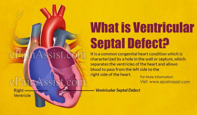 What is Ventricular Septal Defect: Causes, Symptoms, Treatment, Complications, Prevention