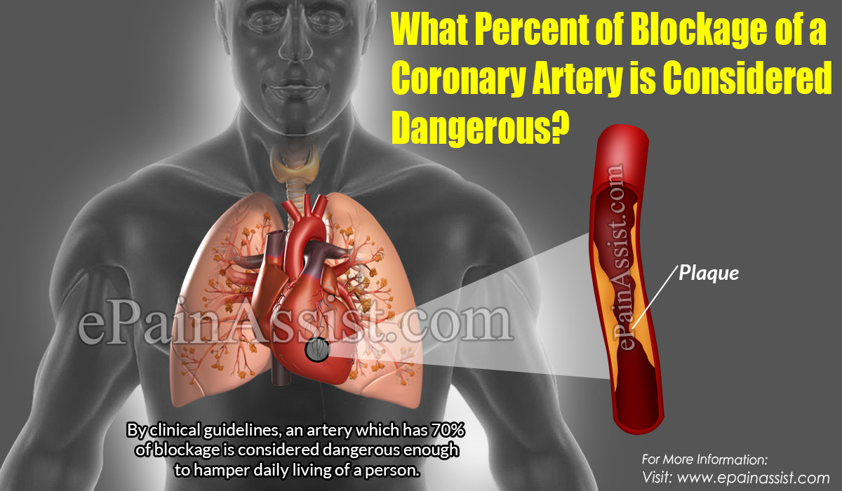 What Percent of Blockage of a Coronary Artery is Considered Dangerous?