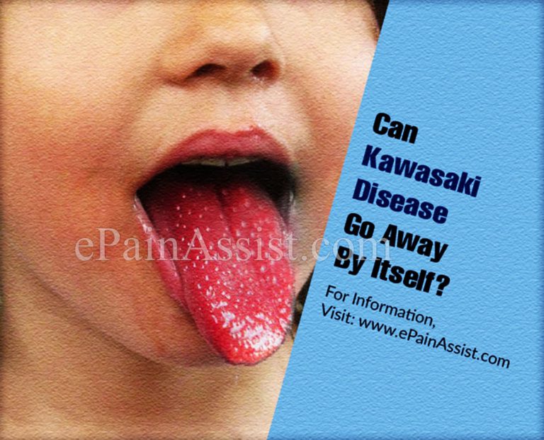 Can Kawasaki Disease Go Away By Itself?