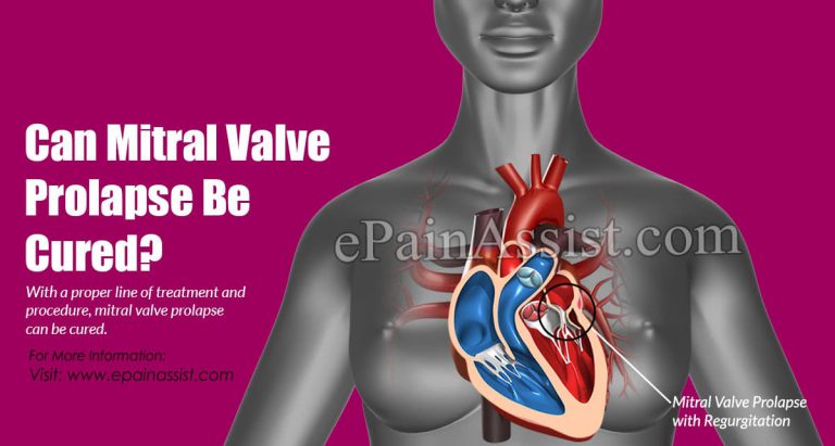 Can Mitral Valve Prolapse Be Cured?