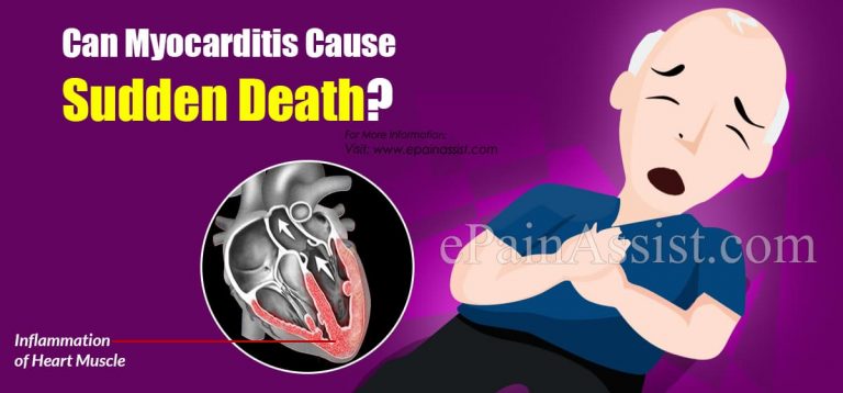 Can Myocarditis Cause Sudden Death?