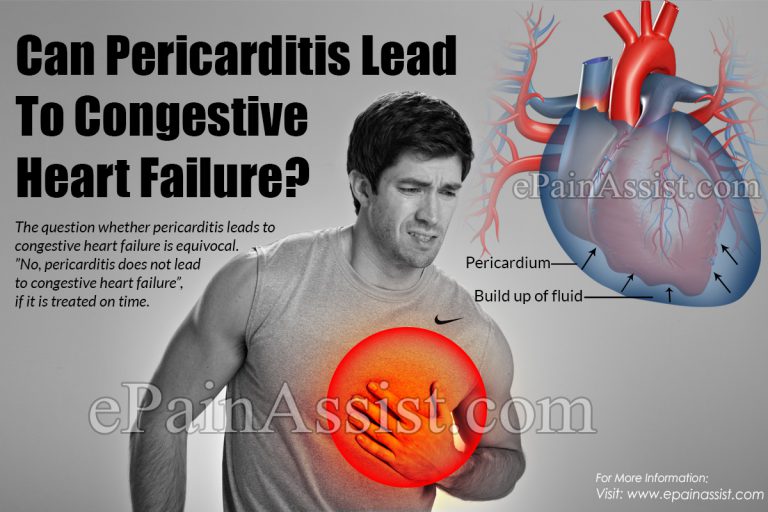 Can Pericarditis Lead To Congestive Heart Failure?