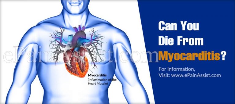 Can You Die From Myocarditis?