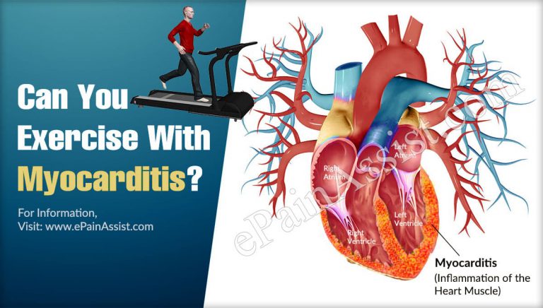 Can You Exercise With Myocarditis?