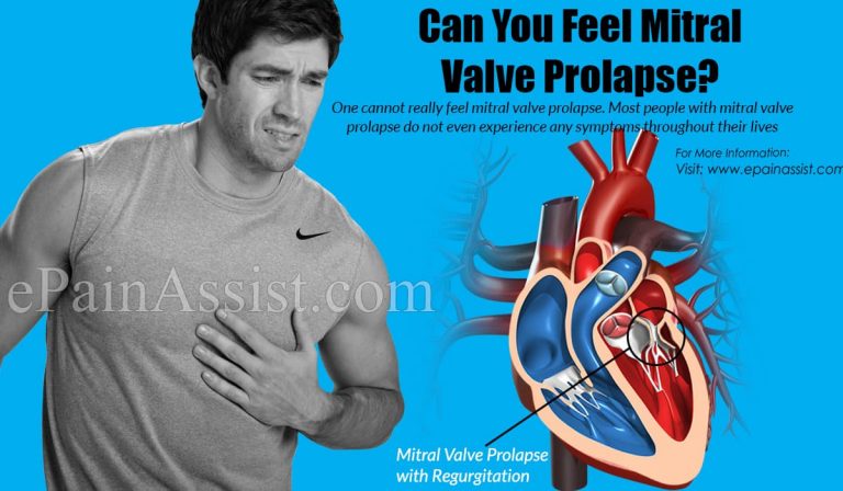 Can You Feel Mitral Valve Prolapse?
