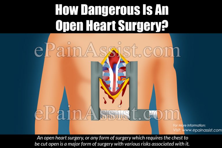 How Dangerous Is An Open Heart Surgery?