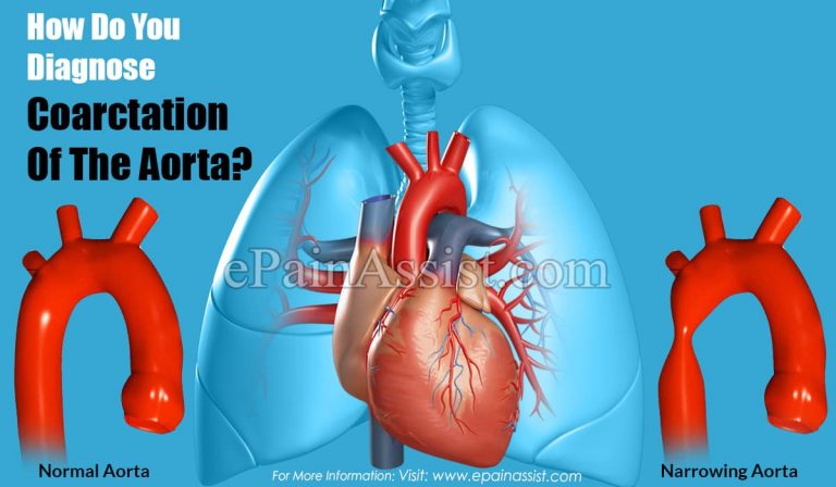 How Do You Diagnose Coarctation Of The Aorta?
