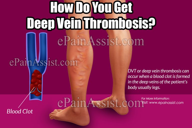How Do You Get Deep Vein Thrombosis & What are its Complications?