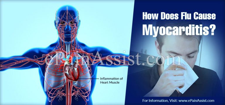 How Does Flu Cause Myocarditis?