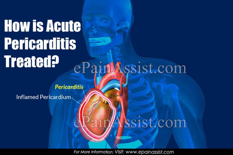 How is Acute Pericarditis Treated?