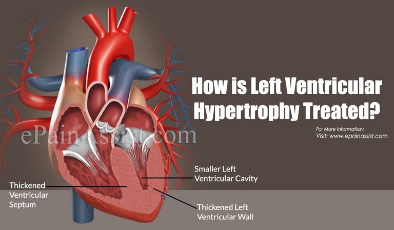 How is Left Ventricular Hypertrophy Treated?