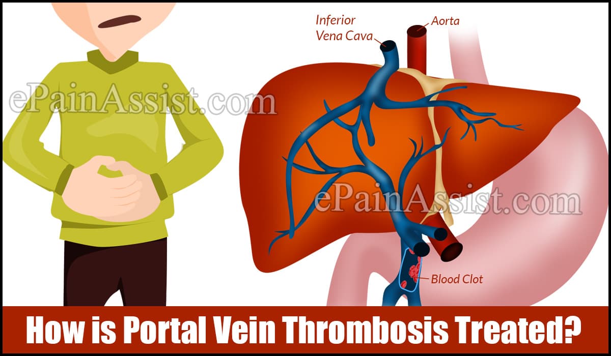 How is Portal Vein Thrombosis Treated?