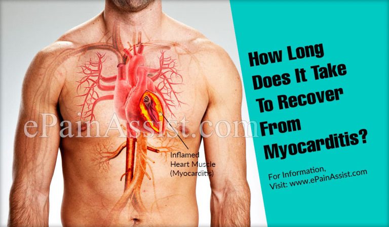 How Long Does It Take To Recover From Myocarditis?