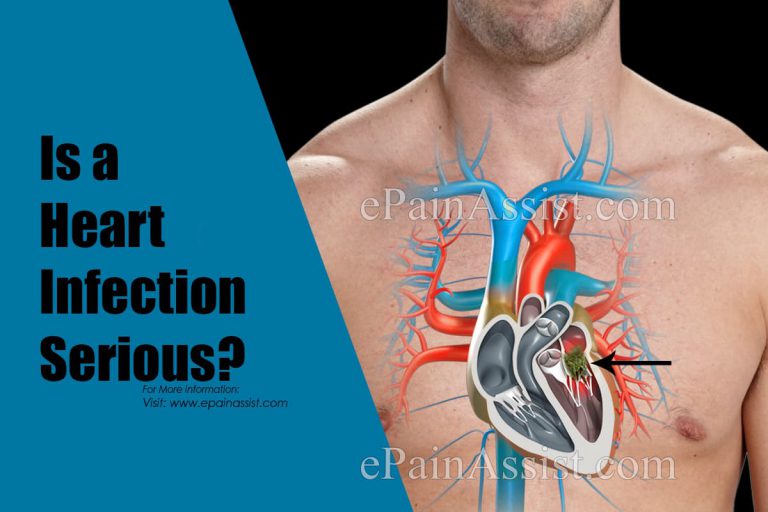 Is a Heart Infection Serious?