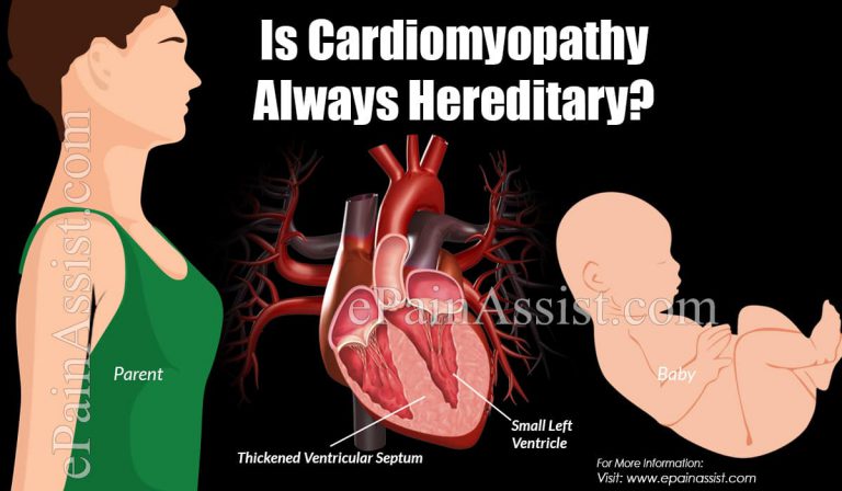 Is Cardiomyopathy Always Hereditary?
