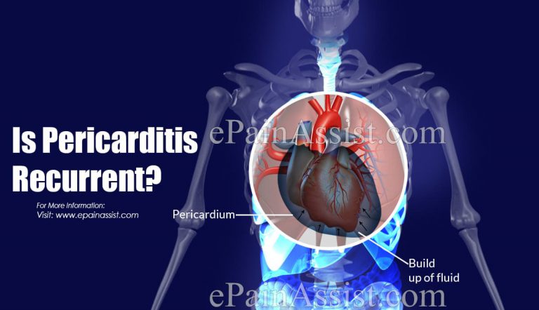 Is Pericarditis Recurrent?