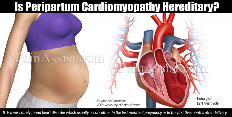 Is Peripartum Cardiomyopathy Hereditary?