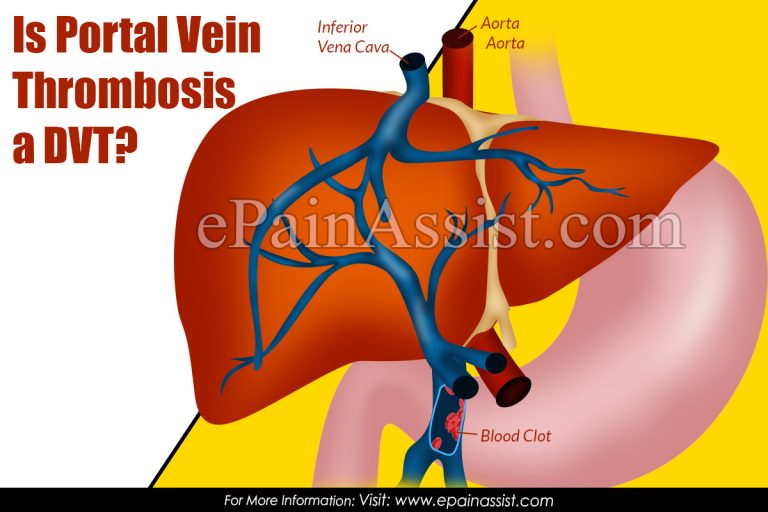Is Portal Vein Thrombosis a DVT?