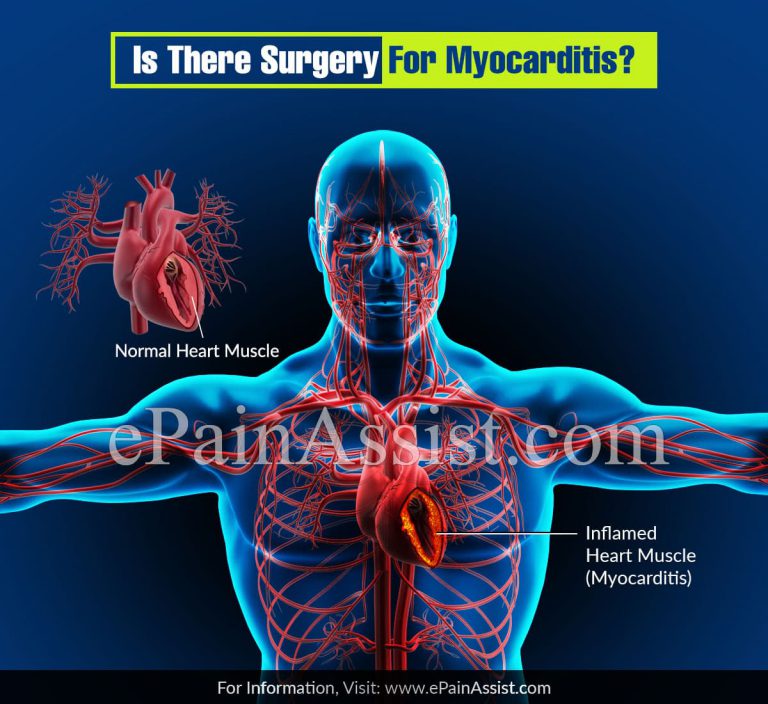 Is There Any Surgery For Myocarditis?