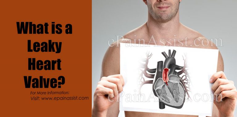 Leaky Heart Valve: Symptoms, Causes, Treatments, Surgery, And More