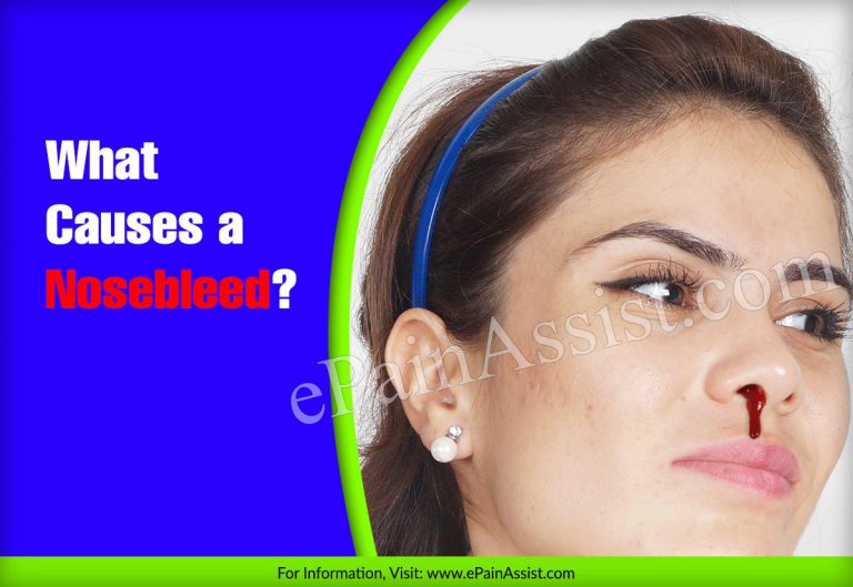 Nosebleeds: Causes, Home Treatments, Cauterization & Nasal Packing, Prevention