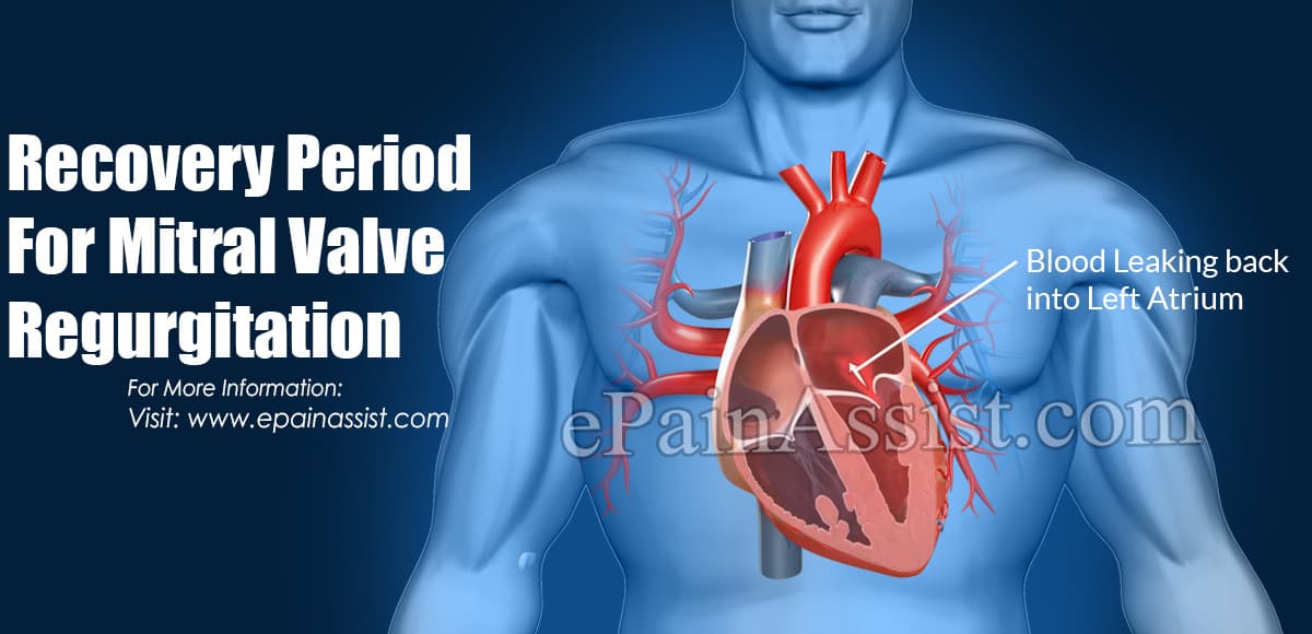 Recovery Period For Mitral Valve Disease