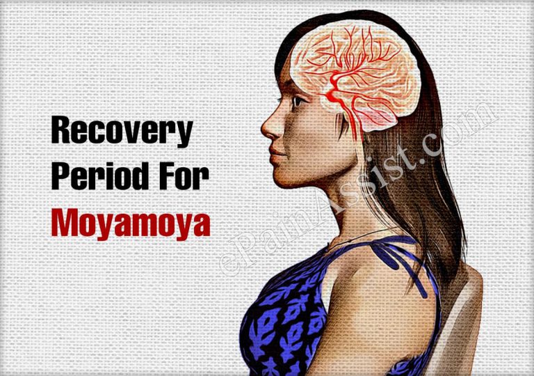 Recovery Period For Moyamoya