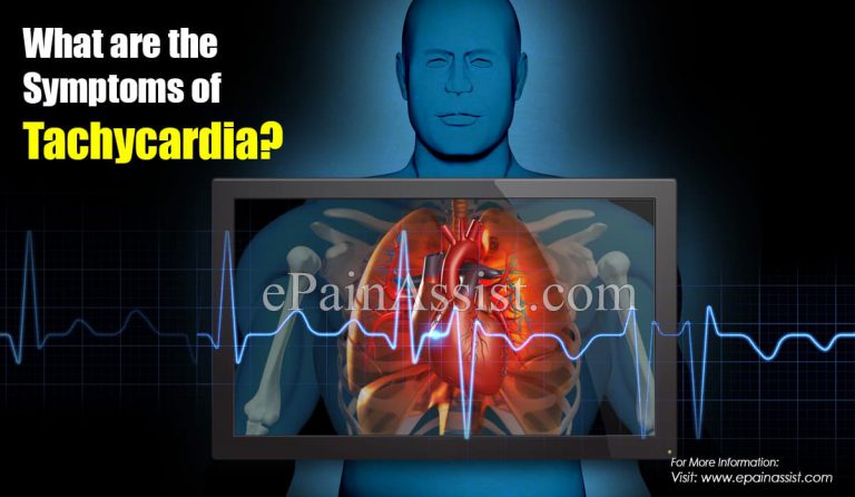 What are the Symptoms of Tachycardia?