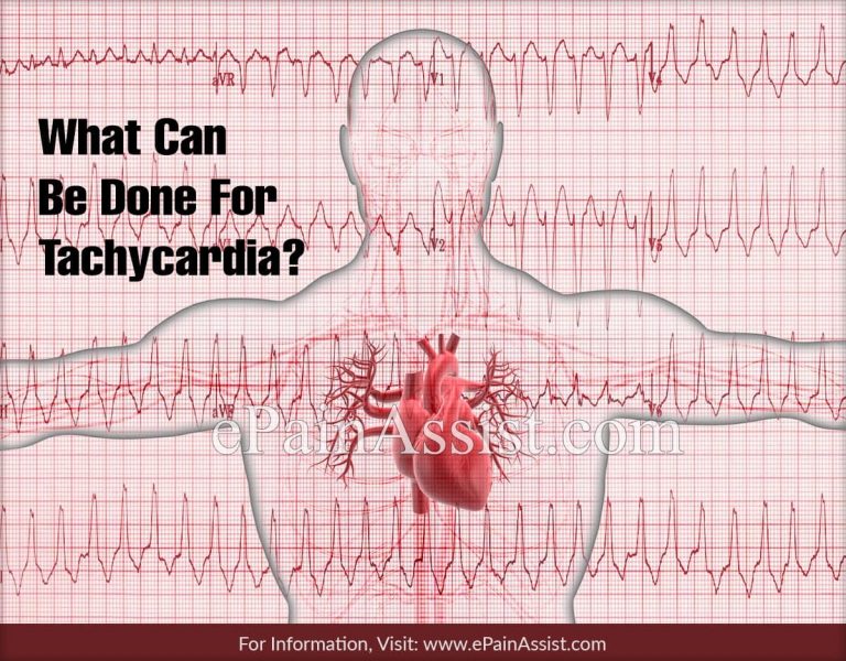 What Can Be Done For Tachycardia?