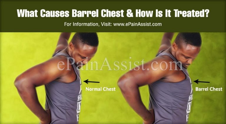 What Causes Barrel Chest & How Is It Treated?