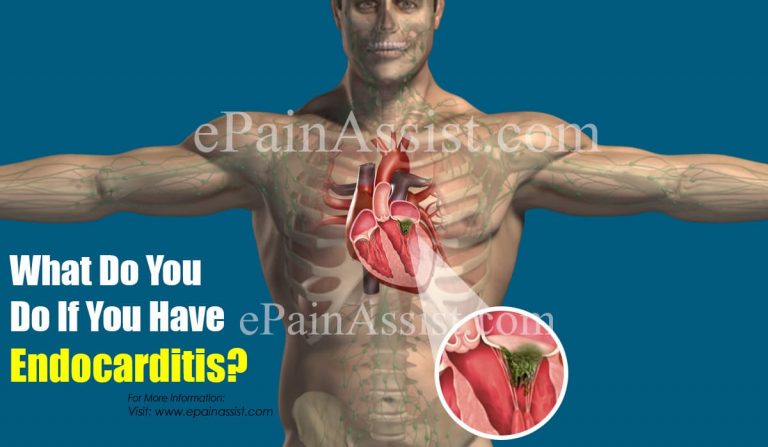What Do You Do If You Have Endocarditis?