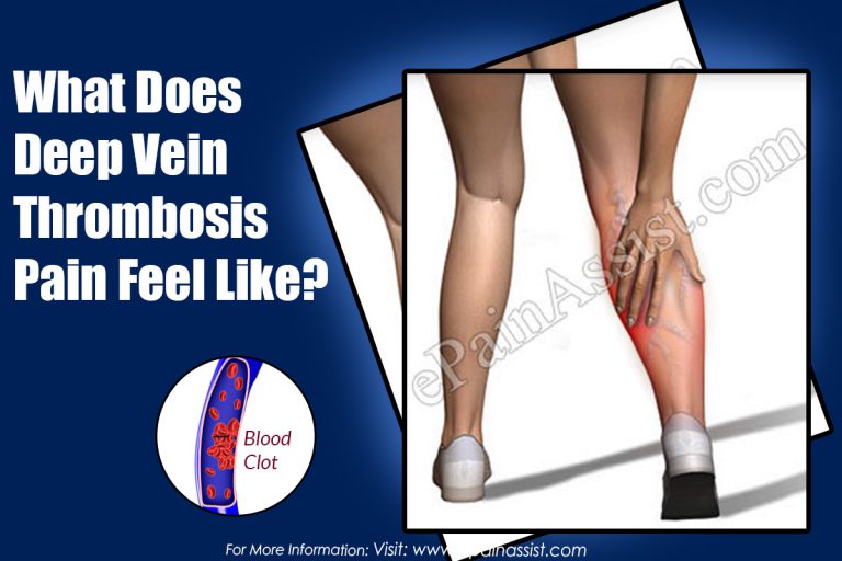 What Does Deep Vein Thrombosis Pain Feel Like?