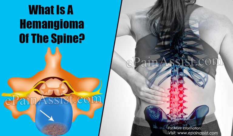 What Is A Hemangioma Of The Spine?