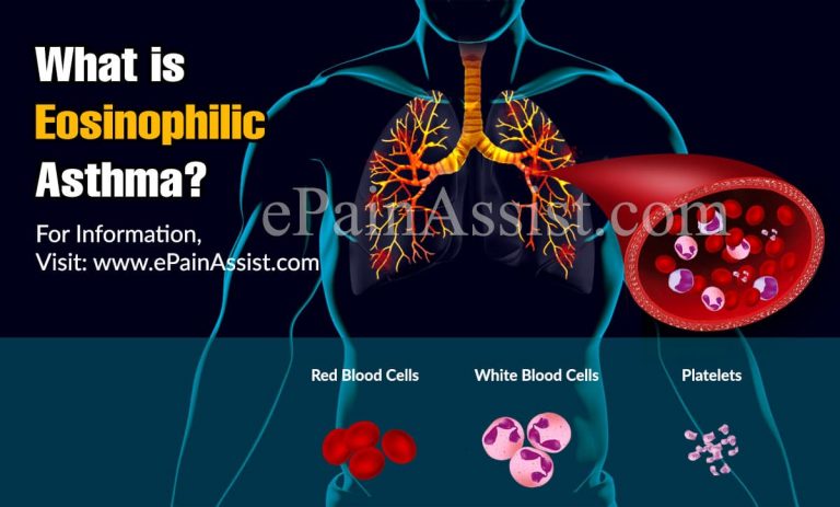 Eosinophilic Asthma: Symptoms & Treatment