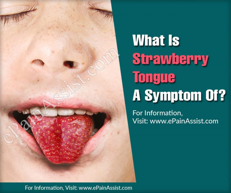 What Is Strawberry Tongue A Symptom Of?