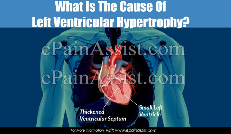 What Is The Cause Of Left Ventricular Hypertrophy?