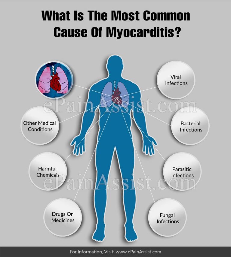 What Is The Most Common Cause Of Myocarditis?