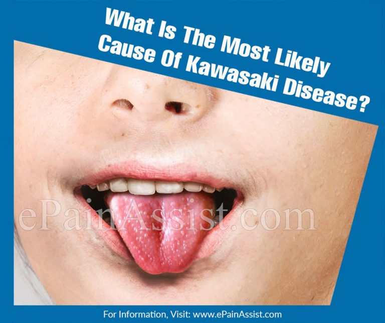 What Is The Most Likely Cause Of Kawasaki Disease?
